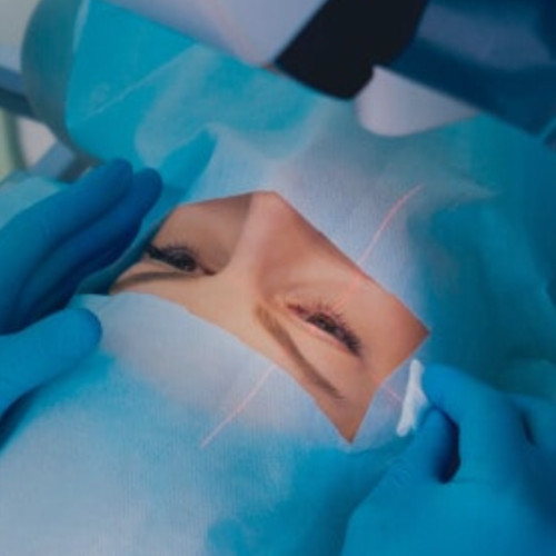 Eine kurzsichtige Patientin während der Augenlaser-Behandlung ihrer Kurzsichtigkeit bei den Augenpartnern Walsrode
